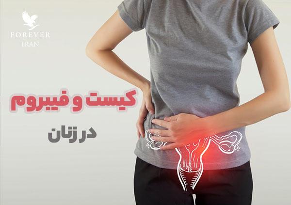 چگونه می توان کیست و فیبروم را درمان کرد؟